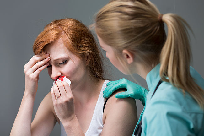 When to Worry about a Nosebleed